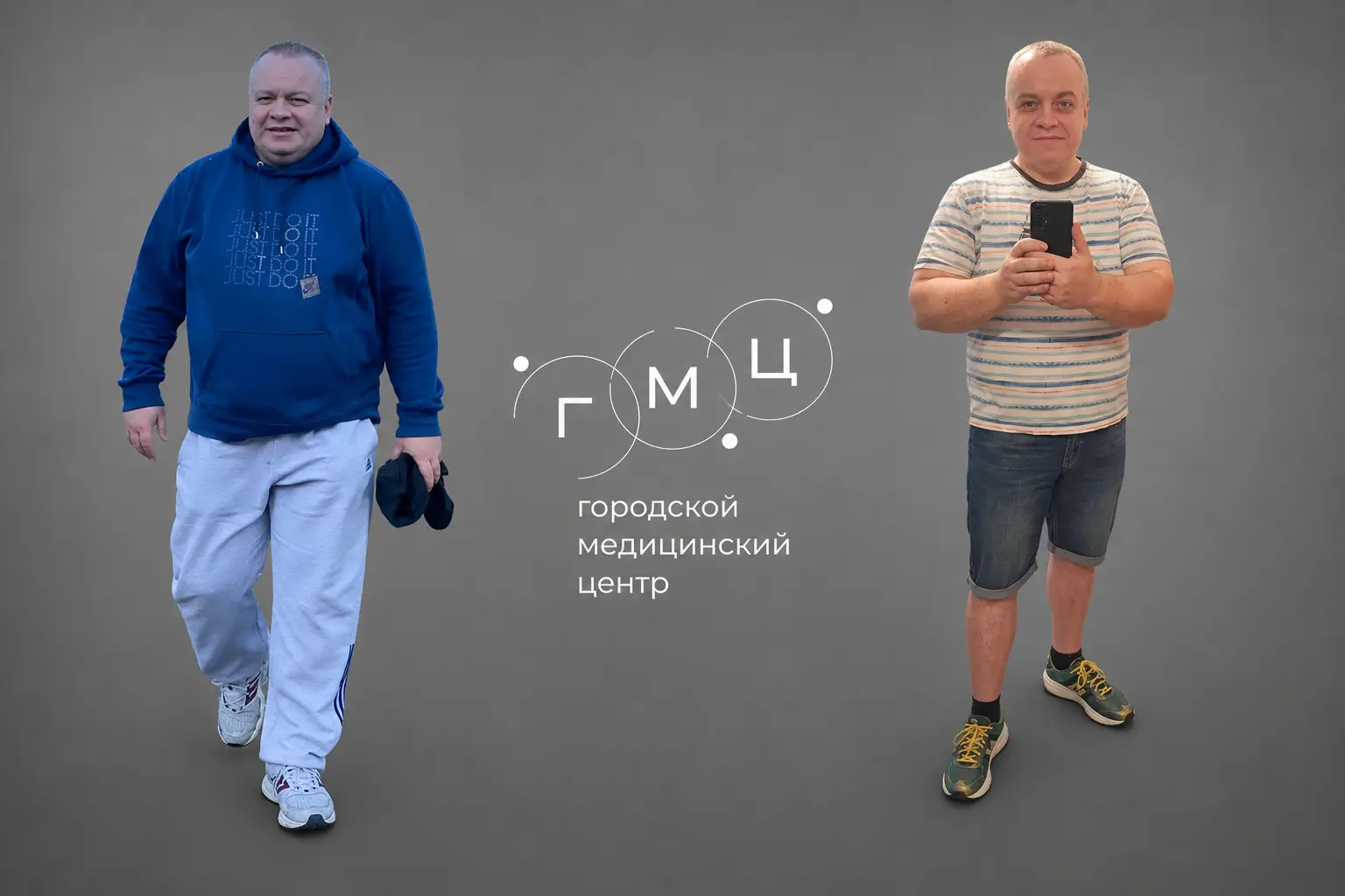 До и после бариатрии